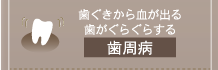 歯ぐきから血が出る歯がぐらぐらする