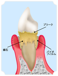 術前